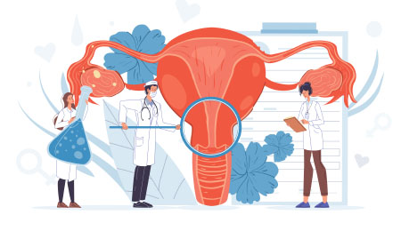 Are you harming your ovary?