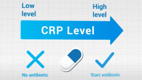 Wondfo CRP Campaign Online Launch—Antibiotic Overuse, Time to Say No!